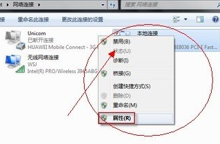 电脑本地连接的ip如何自己设置(2)
